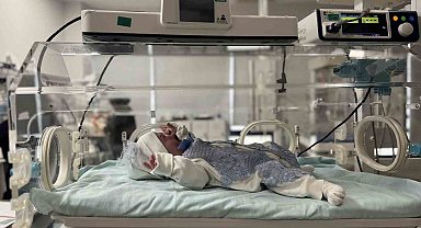 Mardin'de nadir görülen hastalıkla doğan bebek sağlığına kavuştu