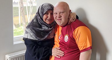Down sendromlu annesinin sosyal alan ve anlayış isteği