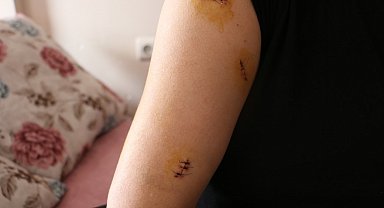 Kocası tarafından 30 yerinden bıçaklandı, görümcesi şikayetini geri çekmesini istedi