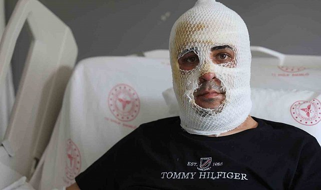 Ekmek teknesi küle dönmesin diye mücadele eden esnafın yüzü ve vücudu yaşanan patlamayla yandı