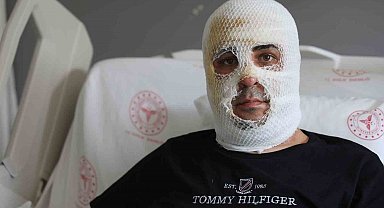 Ekmek teknesi küle dönmesin diye mücadele eden esnafın yüzü ve vücudu yaşanan patlamayla yandı
