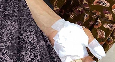 Şırnak'ta başıboş köpek dehşeti: 3 kişi yaralandı