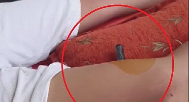 Bahçeye kaçan topu almak isteyen çocuğun bacağına korkuluk demiri saplandı