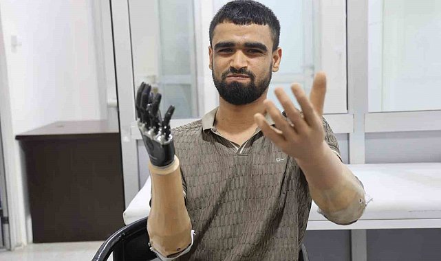 Demirin elektrik tellerine değmesiyle hayatı kararan Muhammed, 3 milyon TL değerindeki protez bacağına ve 2 biyonik koluna kavuştu