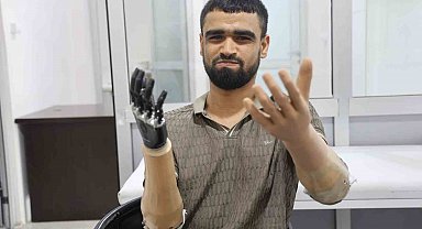 Demirin elektrik tellerine değmesiyle hayatı kararan Muhammed, 3 milyon TL değerindeki protez bacağına ve 2 biyonik koluna kavuştu