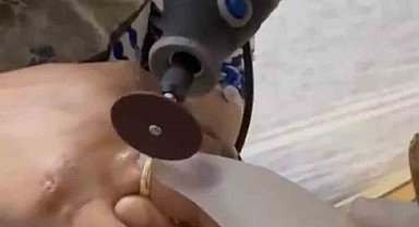 Kazada yaralanan kadının parmağına sıkışan yüzüğü itfaiye ekipleri çıkardı