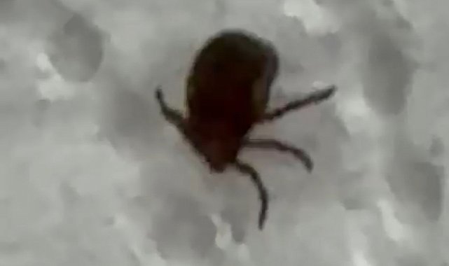 Kenenin ısırdığı vatandaş kontrol amacıyla hastaneye başvurdu