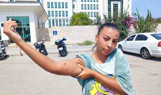 Cankurtaran kadın, öğretmen amcası tarafından darp edildi