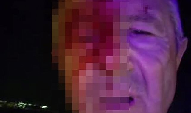 Haber yaparken saldırıya uğrayan muhabir yaralandı