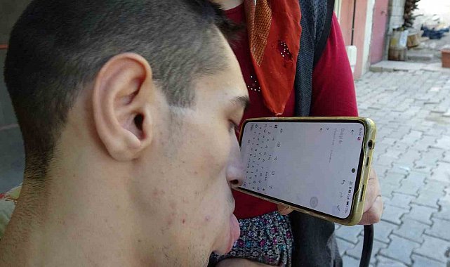Engelleri burnuyla aştı: Telefonuyla hayata tutundu
