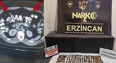 Erzincan'da uyuşturucuyu vücutlarında taşıyan 3 şüpheli yakalandı