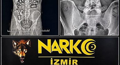 Havalimanında şüpheli yolcuların midesinden uyuşturucu çıktı