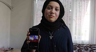 Kanseri yenen Buse'nin hayali kendisi gibi hastalara umut olmak