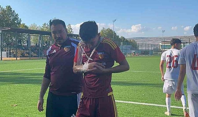 Kayserispor U19'da Hilmi Türkan'dan kötü haber