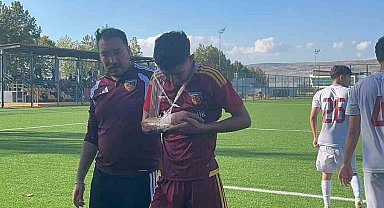 Kayserispor U19'da Hilmi Türkan'dan kötü haber