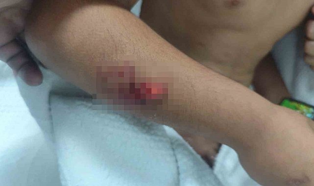 Köpek saldırısına uğrayan çocuğun başına 15 dikiş atıldı